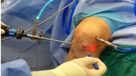 Treatments for Knee Pain