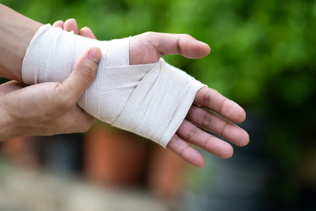 A wrapped, injured hand.