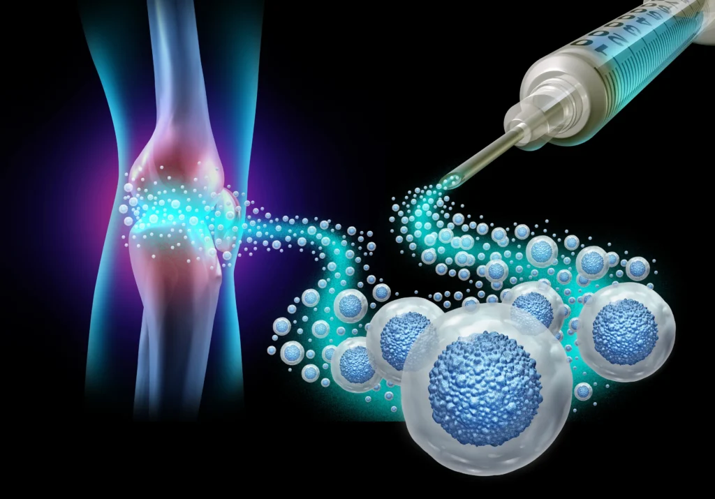 A visual representation of stem cell therapy for pain.